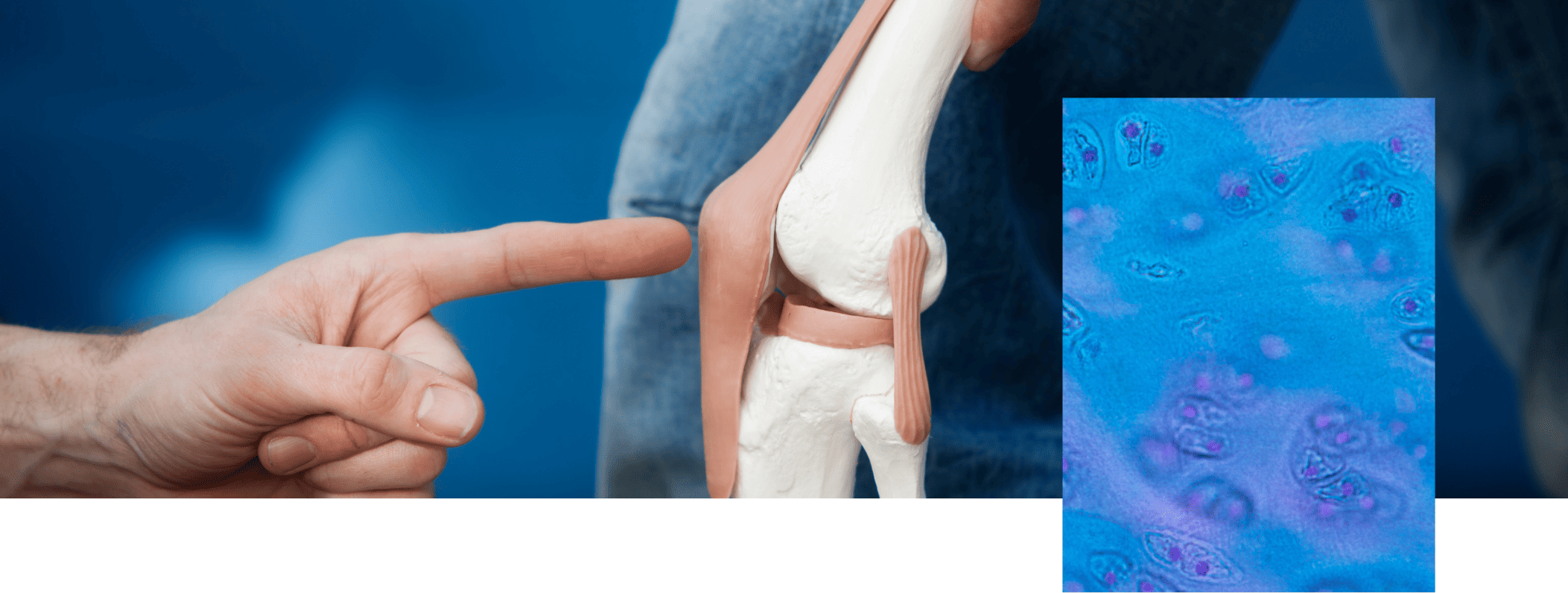 Schéma de l'anatomie d'une articulation et de son cartilage, Therascience