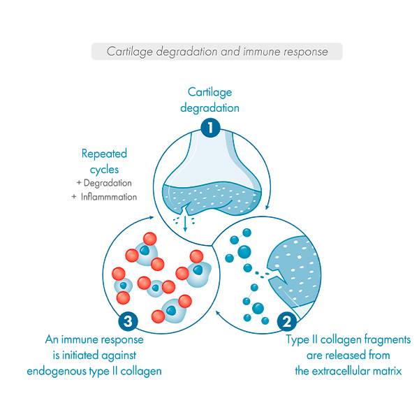schema dégradation du cartilage